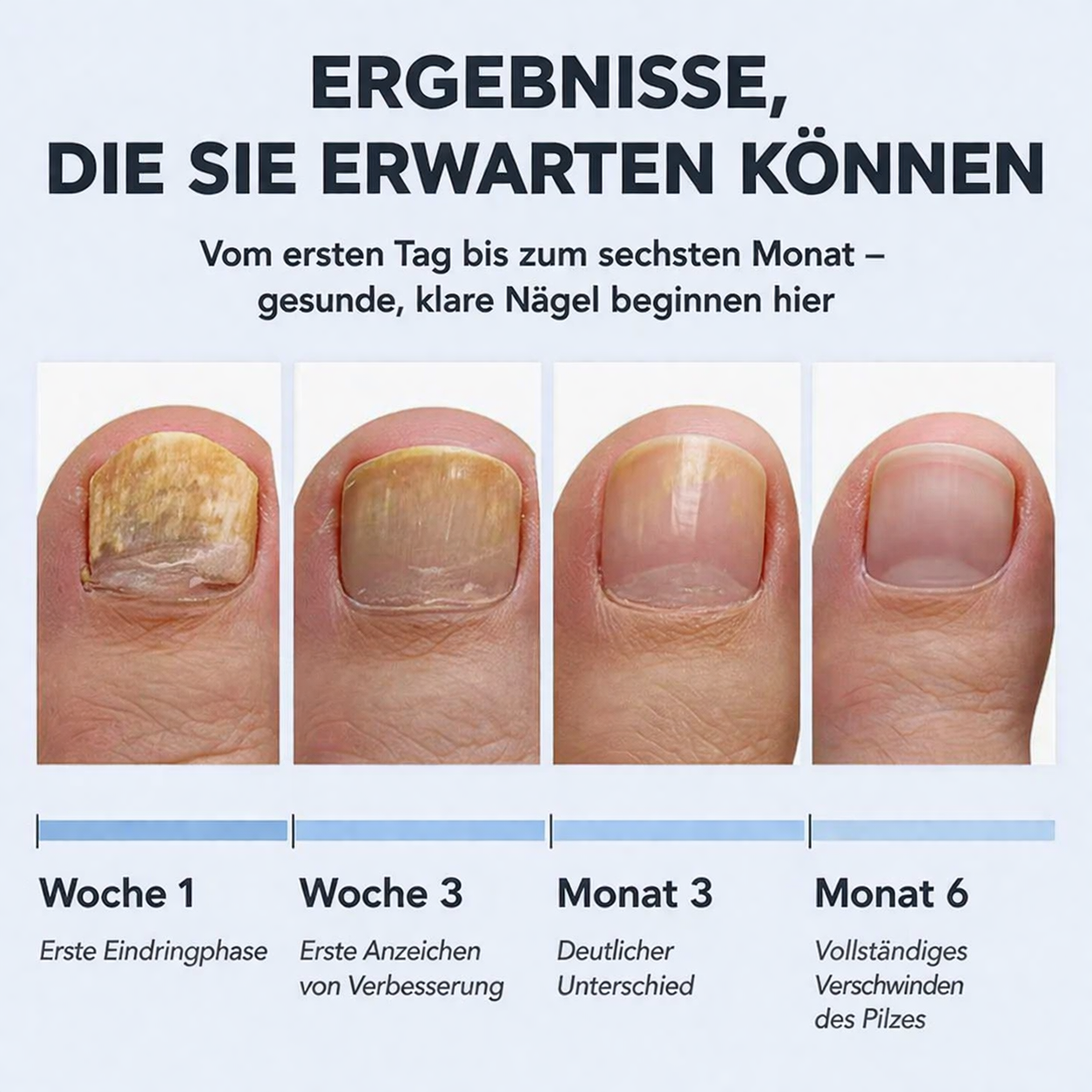 dayoon™ Antifungal | 1+1 Gratis!