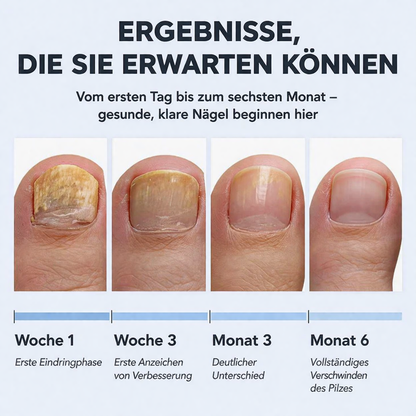 dayoon™ Antifungal | 1+1 Gratis!