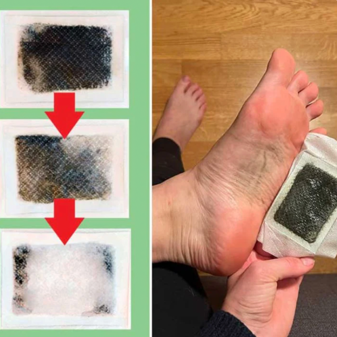 dayoon™ DetoxPatch | 1+2 Gratis!