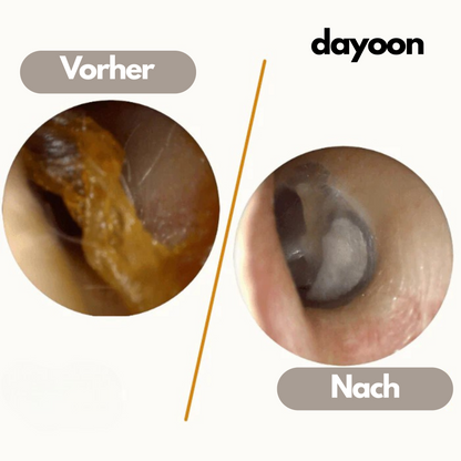 Dayoon™ EarVac